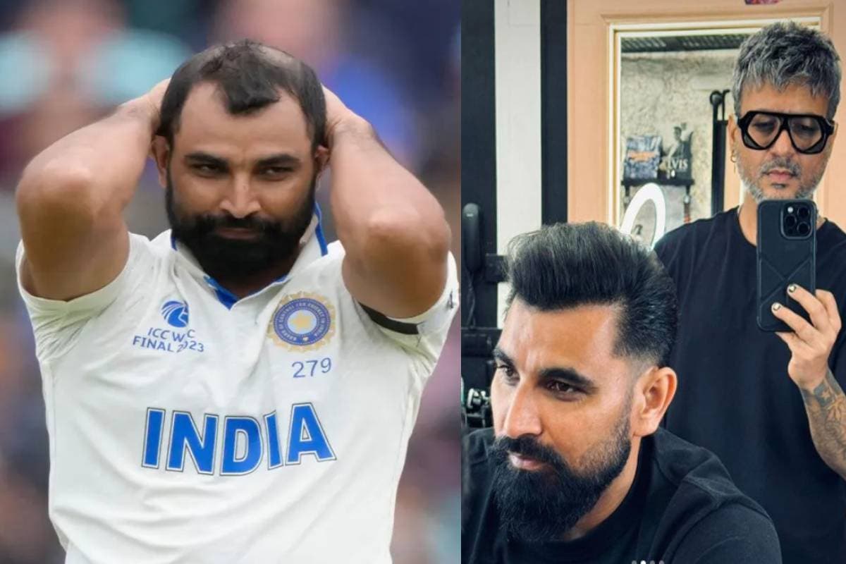 Hair Transplant: क्रिकेटर मोहम्मद शमी के नए बाल उगते ही बदला लुक, जानें कैसे और कितना आया खर्च