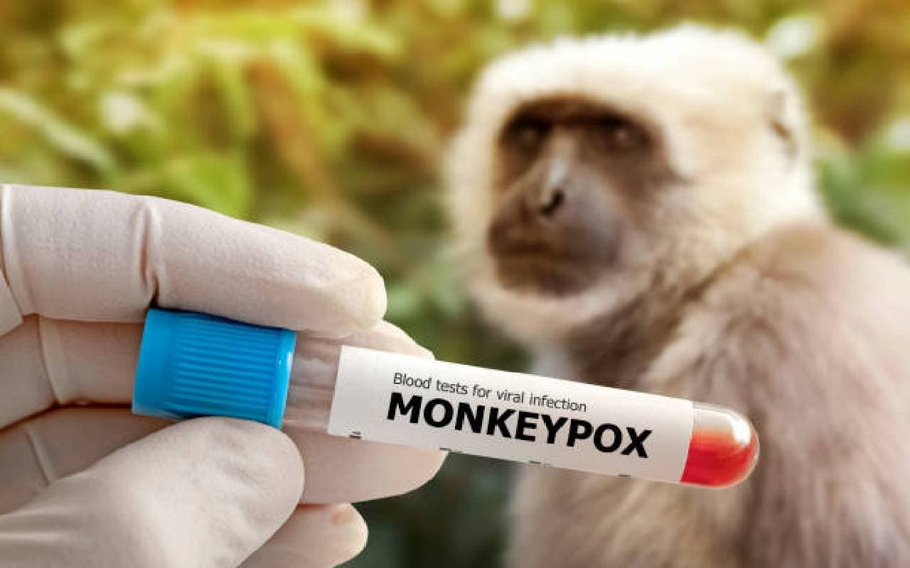 MonkeyPox: कैसे फैलता है मंकीपॉक्स वायरस, कितने दिनों तक रहता है असर? इस बारे में जानें बड़ी बात