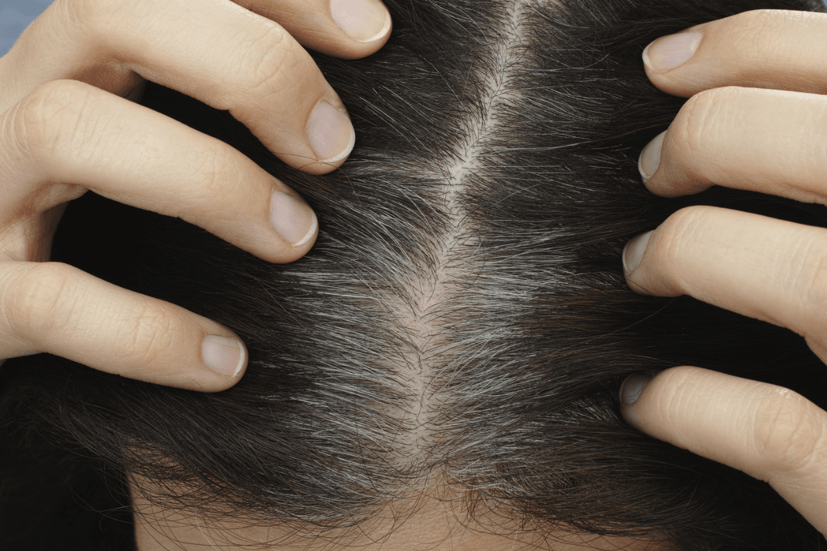 Home Remedies: सफेद बालों को नेचुरल तरीके से रंगने के सरल और प्रभावी घरेलू उपाय