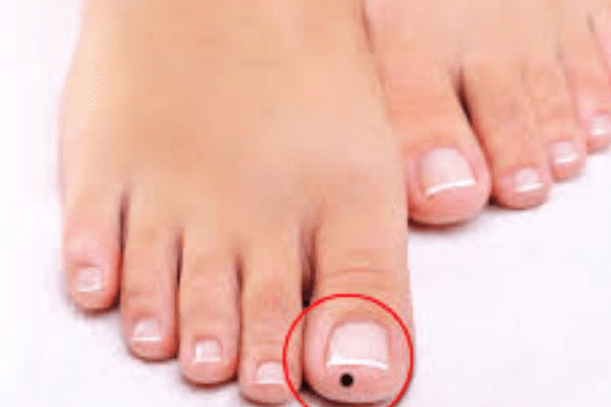 Personality test: पैर के अंगूठे में तिल का रहस्य, जानिए इसके संकेत और प्रभाव