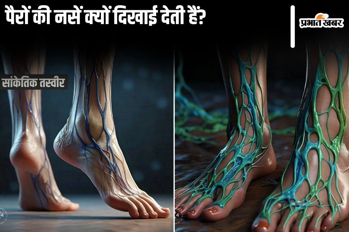 Visible Leg Veins: पैरों की नसें क्यों दिखाई देती हैं?