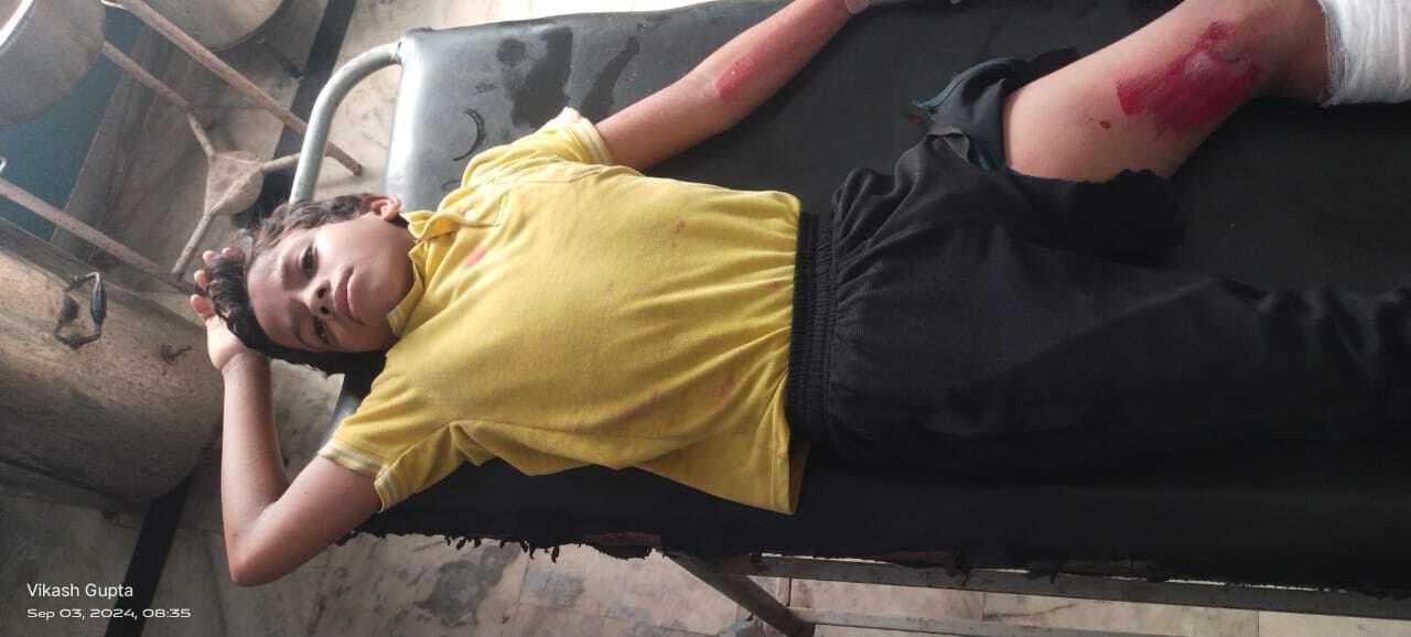 Accident news: टेंपो पलटी, एक दर्जन स्कूली बच्चे जख्मी