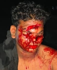 साला ने जीजा को गड़ासे से किया गंभीर रूप से जख्मी, मामला दर्ज