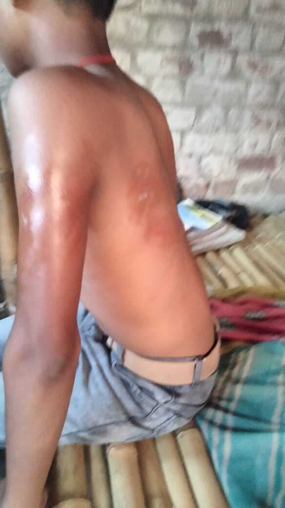 शिक्षक की पिटाई से छात्र जख्मी, परिजनों ने पुलिस को बुलाया