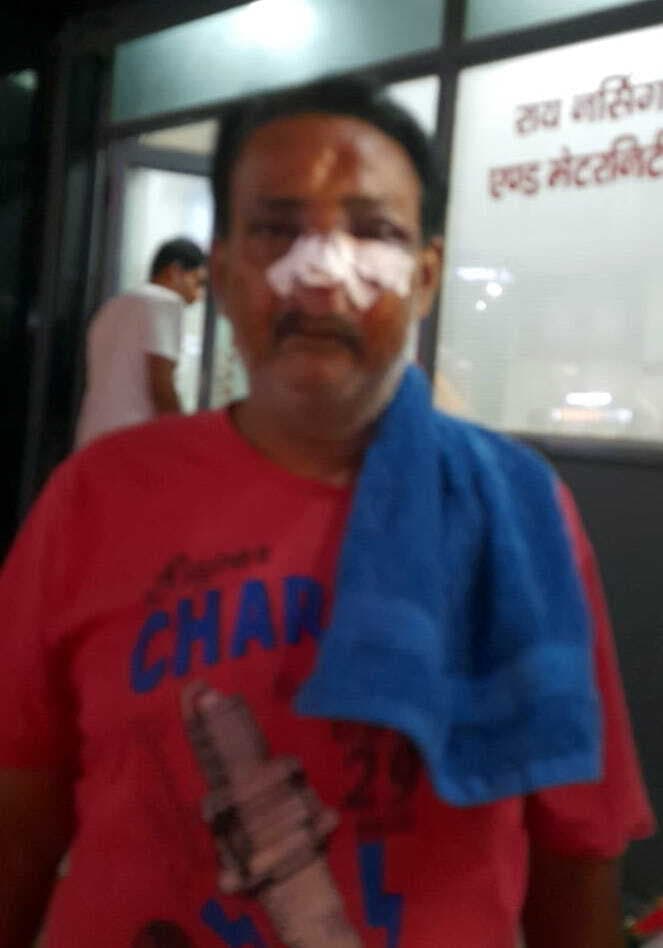पिस्टल की बट से मारकर लूट ली चेन, रिटायर्ड इंजीनियर के नाक की हड्डी टूटी