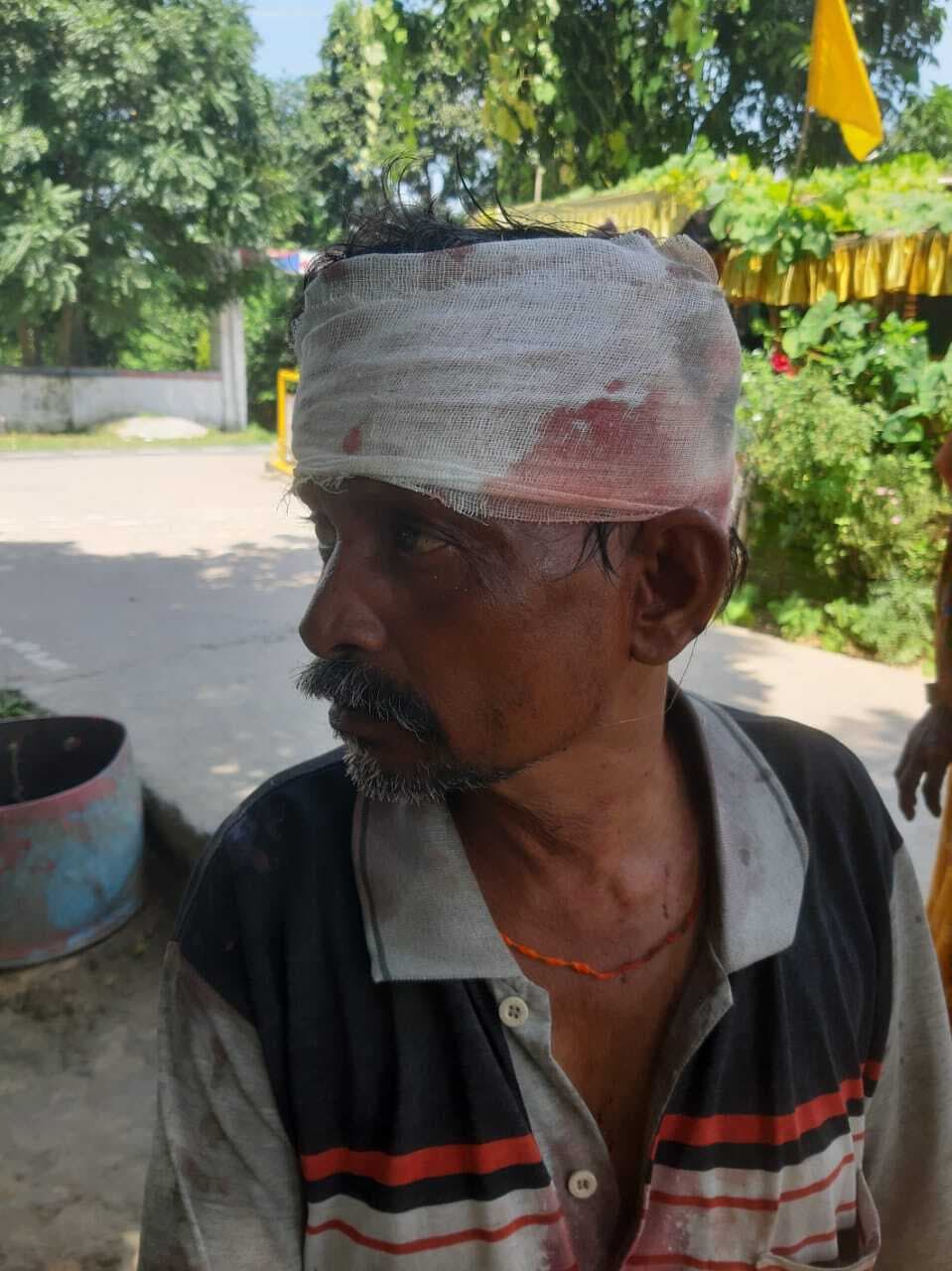 मारपीट की घटना में पति-पत्नी जख्मी