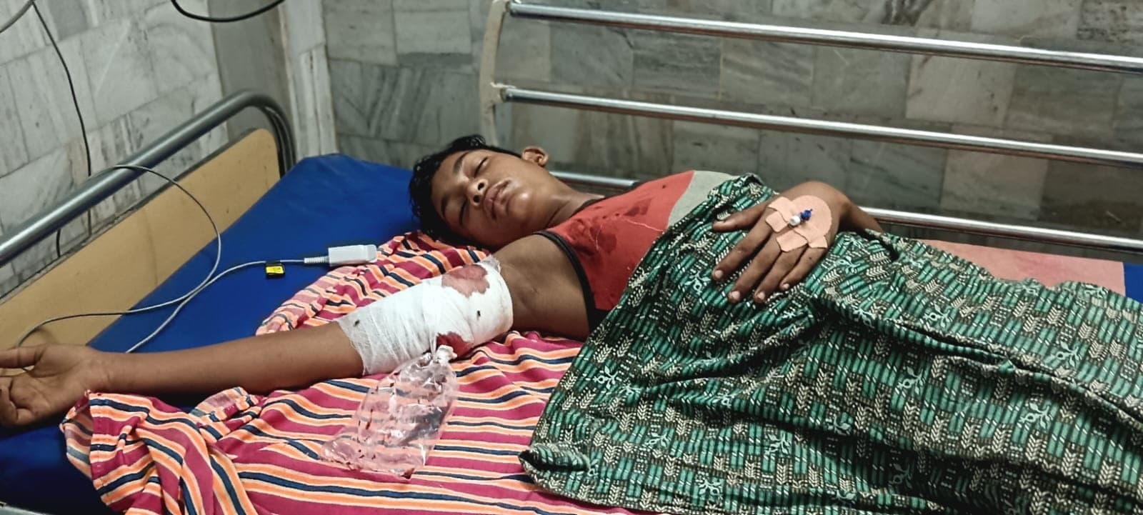 Teenager shot : हसनपुर के बंगराहा में किशोर को मारी गोली