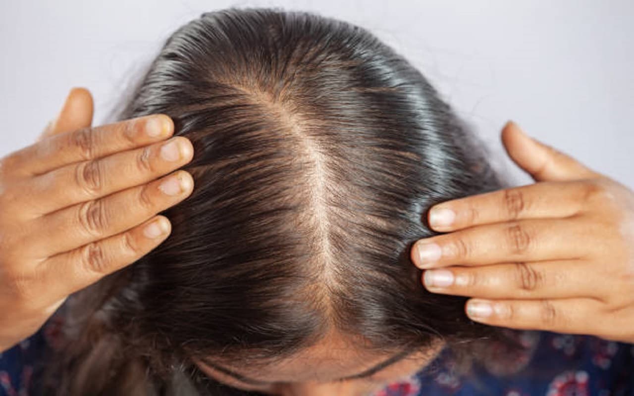 Monsoon Hair Care: शैम्पू के बाद भी चिपचिपे लगते हैं बाल? इन तरीकों से दूर होगी समस्या