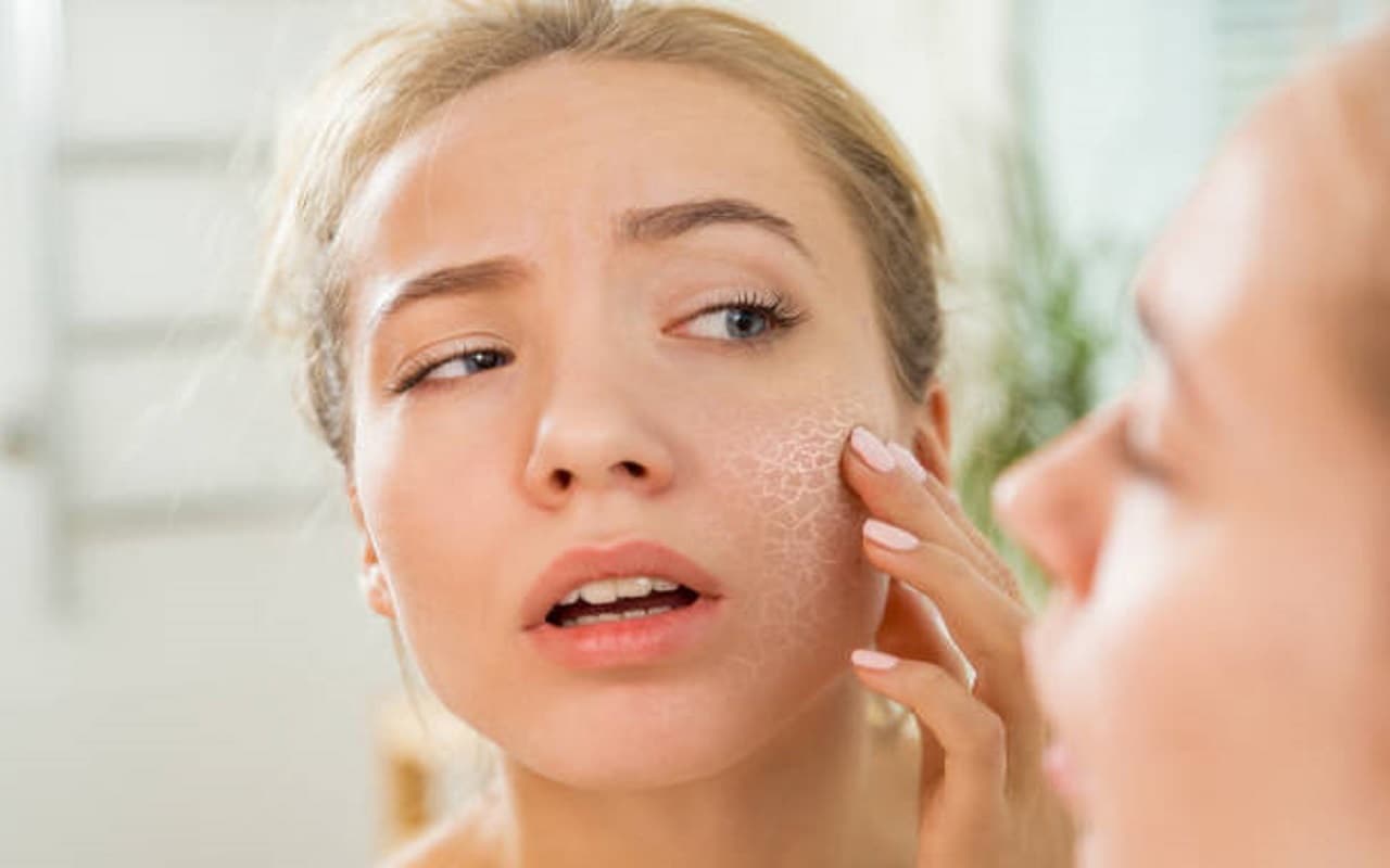 Monsoon Skin Care: अगर बरसात के मौसम में स्किन हो जाती है रूखी और बेजान, तो अपनाएं ये तरीके