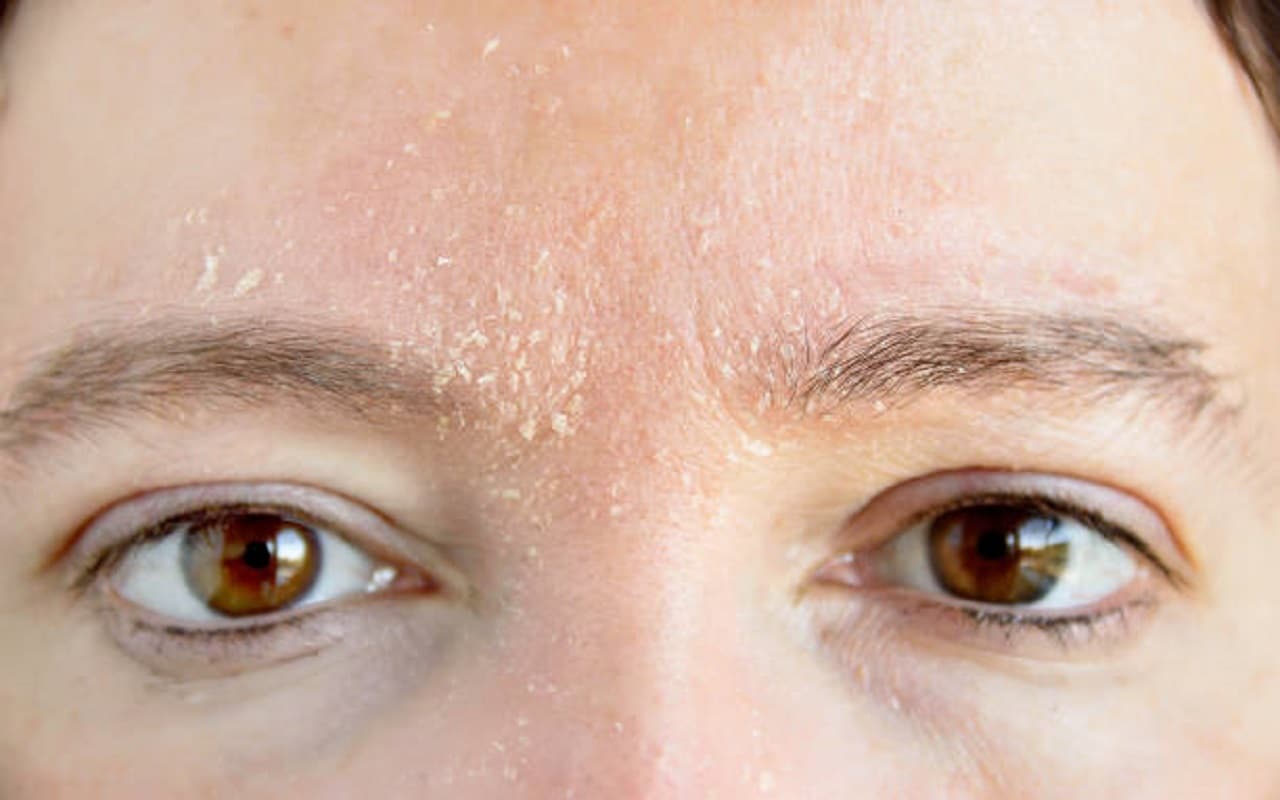 Skin Care Tips: ड्राई स्किन को कहें अलविदा, नरम और कोमल त्वचा पाने के लिए अपनाएं ये घरेलू उपाय