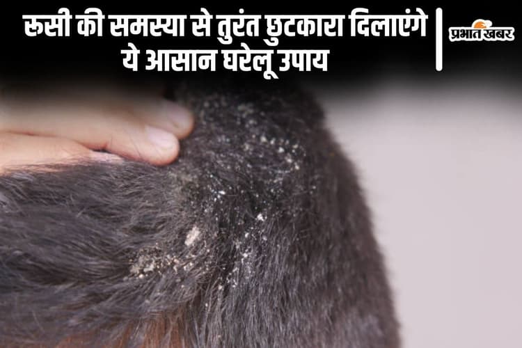 Hair Care Tips: रूसी की समस्या से तुरंत छुटकारा दिलाएंगे ये आसान घरेलू उपाय