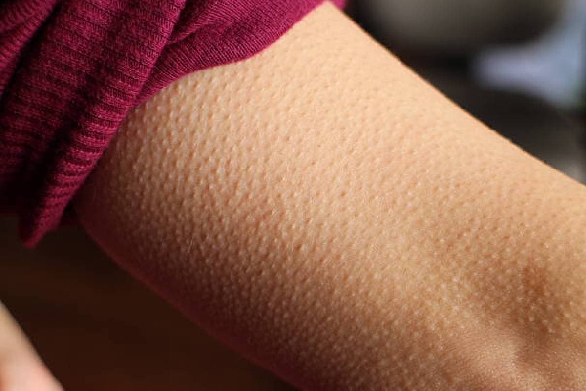 Goosebumps: ठण्डे या भावुक होने पर क्यों खड़े हो जाते हैं रोंगटे, जानें क्या कहता है रिपोर्ट