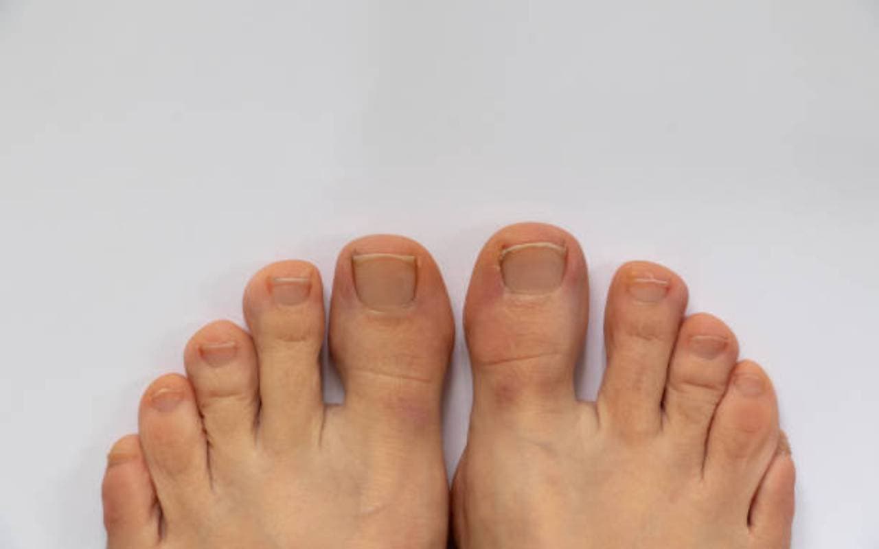 lucky Boy: पैर की उंगलिया अंगूठे के बराबर है तो मिलता है स्त्री सुख, जानें कैसे है आपका भाग्य