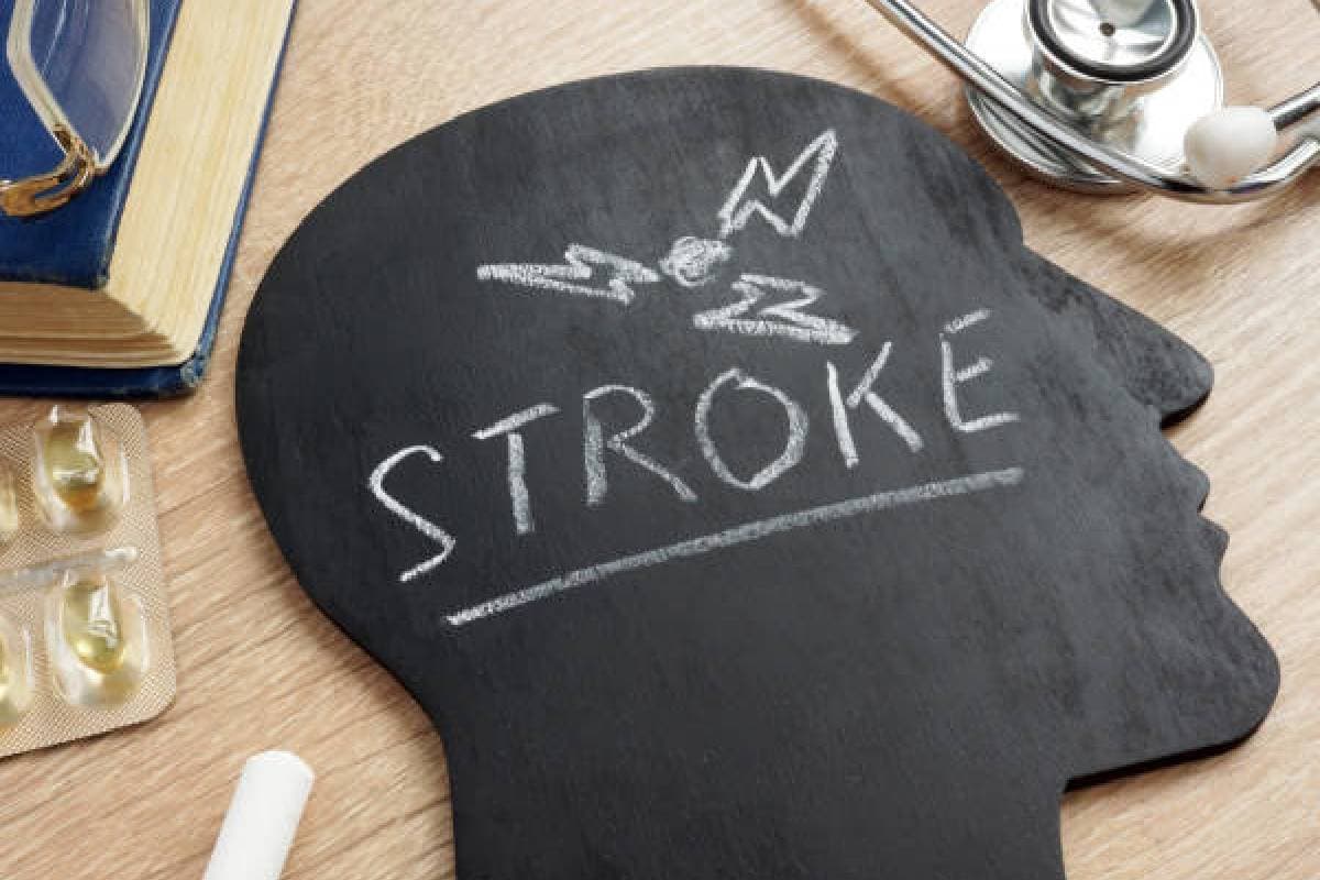 World Stroke Day 2024: स्ट्रोक के 92% मरीज घर पर रहने की तुलना में यहां हुए तेजी से ठीक, सर्वे से चला पता