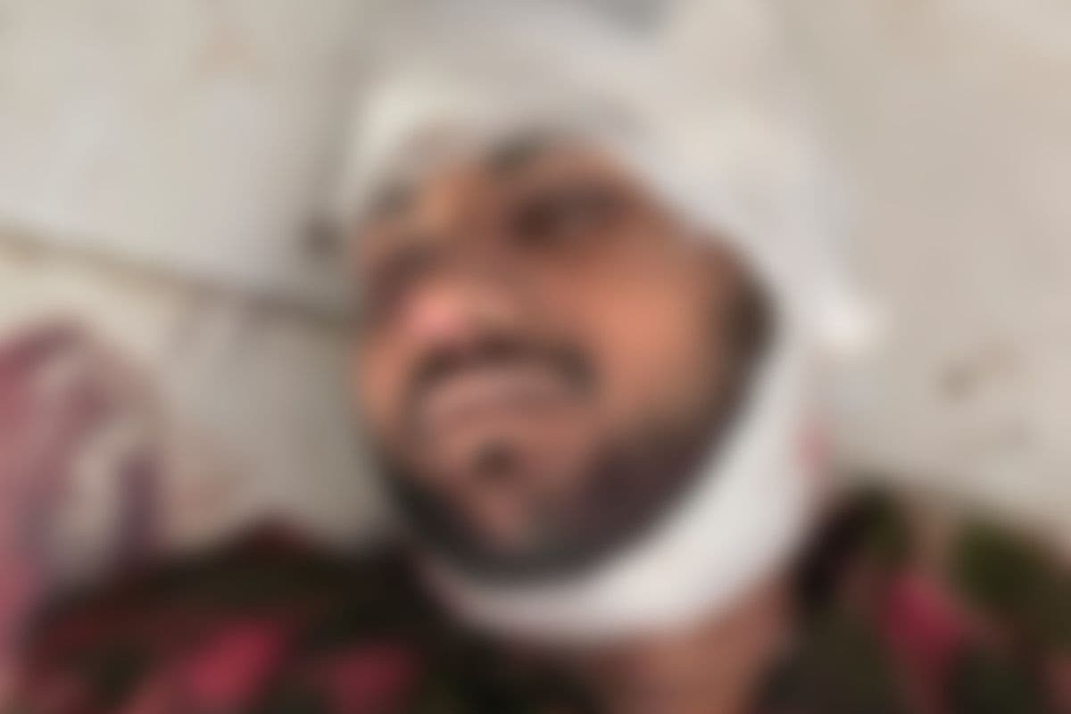 यूपी पुलिस के एनकाउंटर में 1.5 लाख का इनामी बदमाश ढेर, इंस्पेक्टर के साथ सिपाही को भी लगी गोली