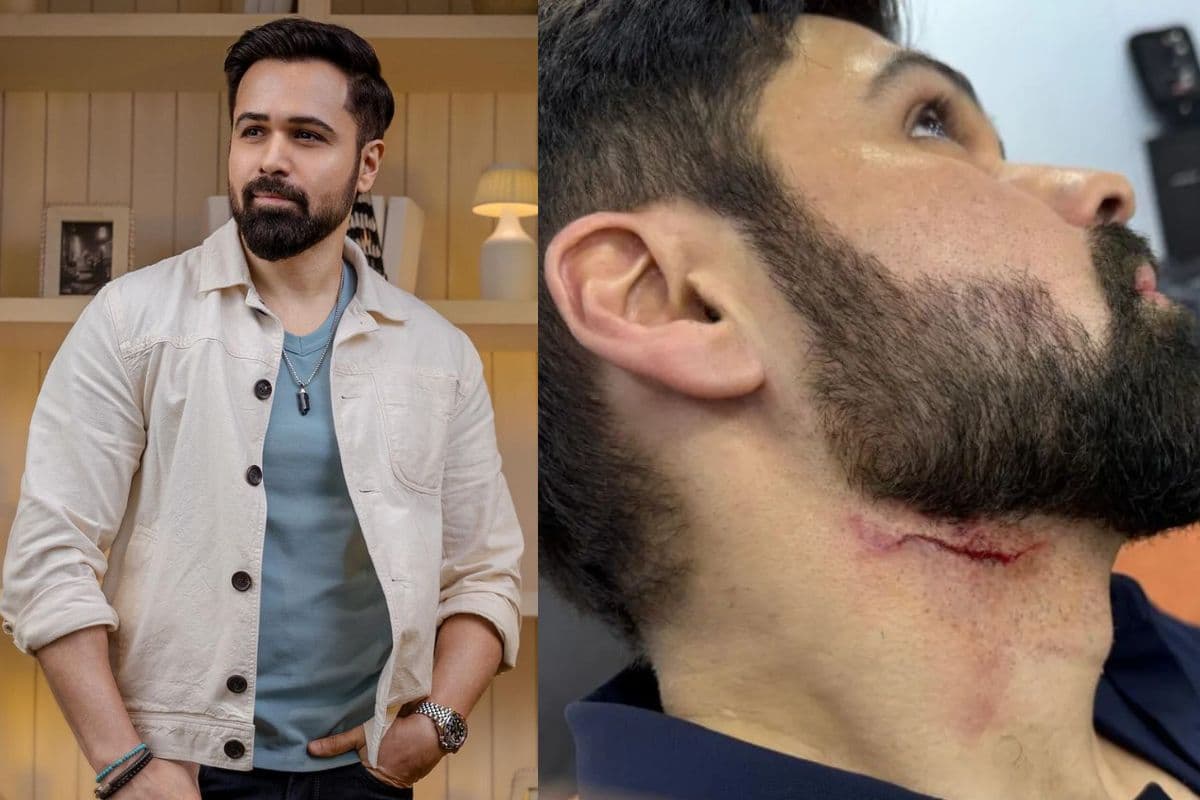 Goodachari 2: एक्शन सीन की शूटिंग के दौरान बुरी तरह जख्मी हुए Emraan Hashmi, तस्वीरें देख फैंस परेशान