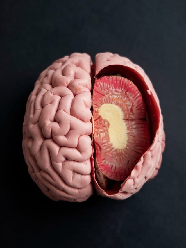 5 बुरी आदतें कर रहीं हैं Brain Health को प्रभावित