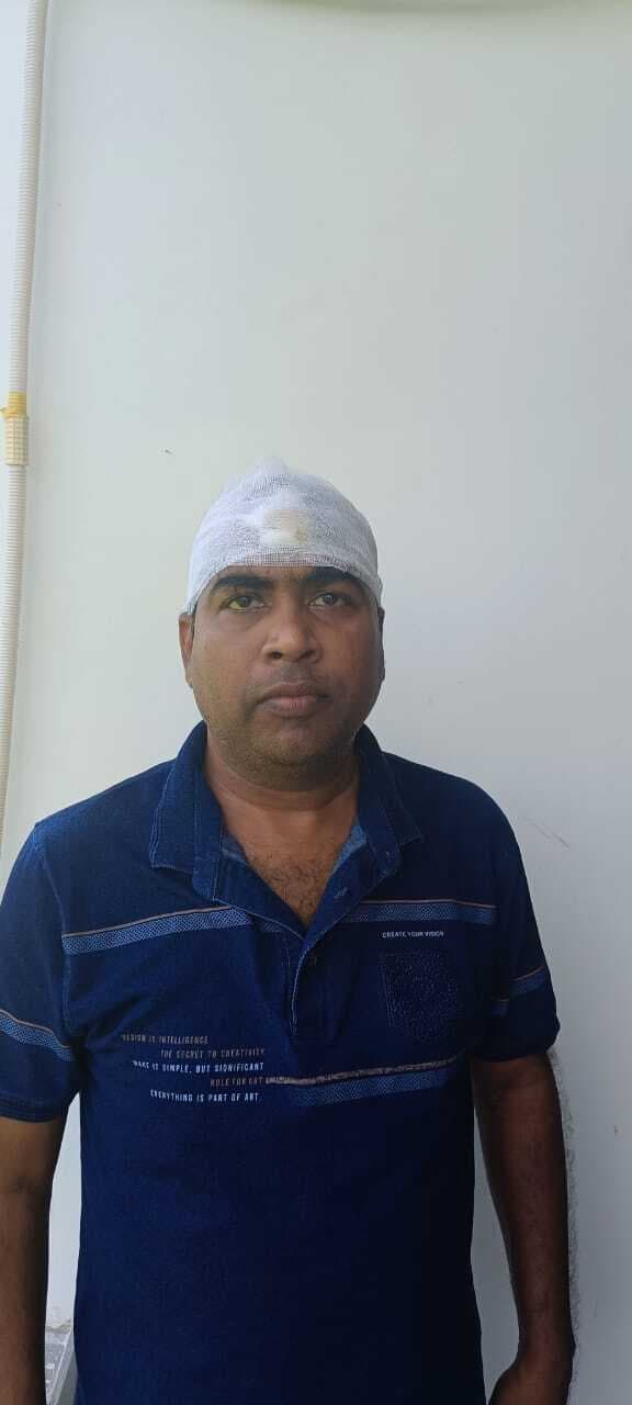 सीओ को ई-रिक्शा ने मारी ठोकर, घायल