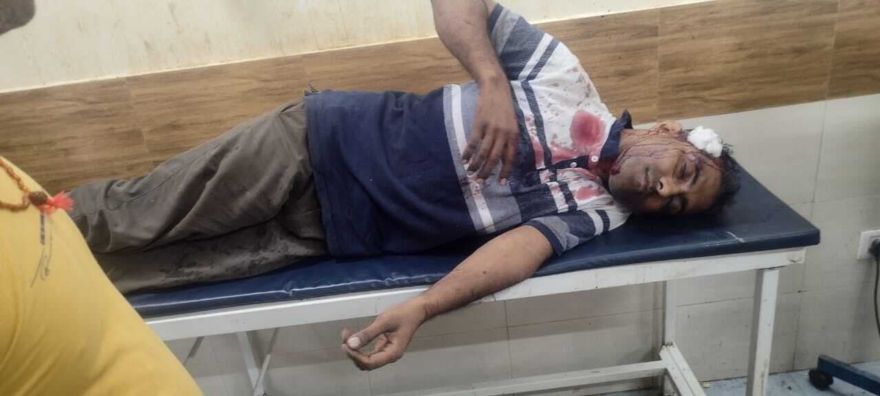 अपराधियों ने दुकानदार को जख्मी कर छीने बाइक, पुलिस जांच में जुटी