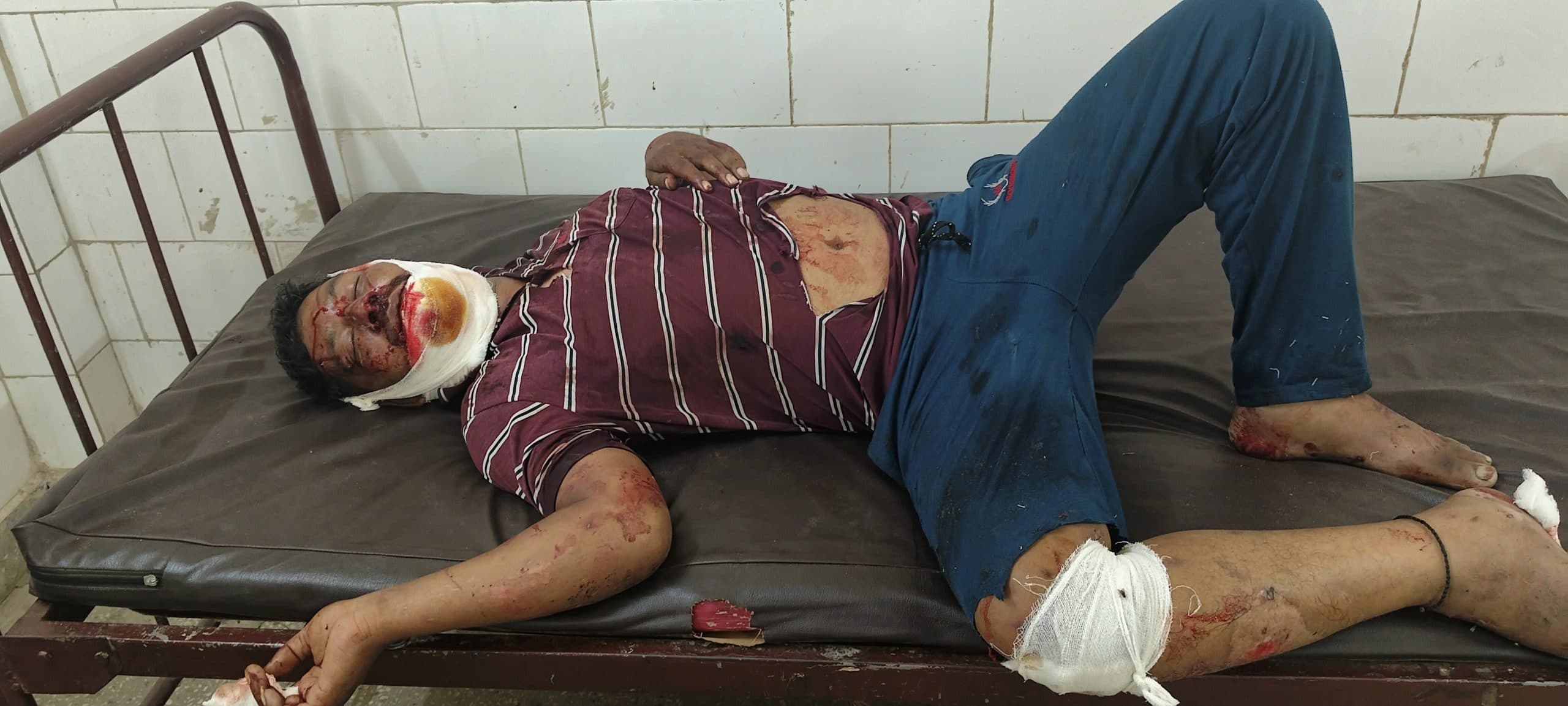 अज्ञात वाहन के धक्के से शख्स घायल, धनबाद रेफर