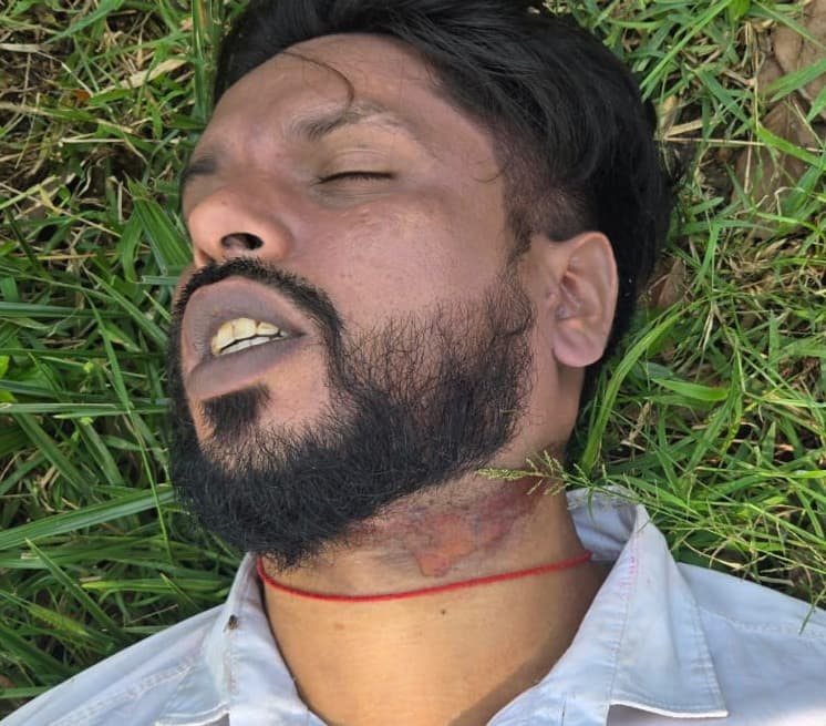 कटहल के पेड़ में फंदा लगाकर युवक ने की आत्महत्या, मृतक के विरुद्ध विभिन्न थाना में कई मामला है दर्ज