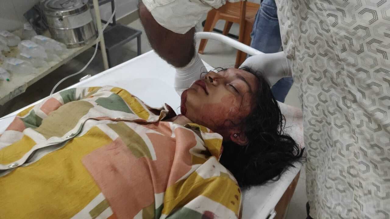 शिवलोक कैंपस में तारामाची से गिरकर दो बच्चे गंभीर, रेफर