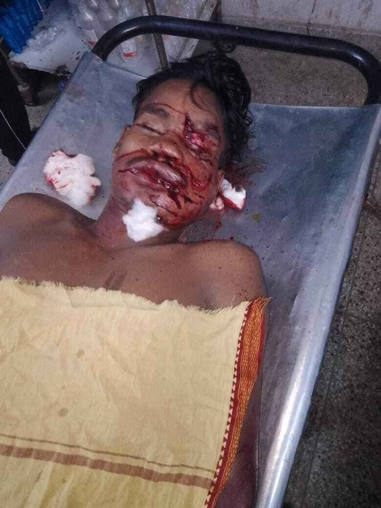 बुरी तरह पीट कर युवक को बीच सड़क पर फेंका, पटना रेफर