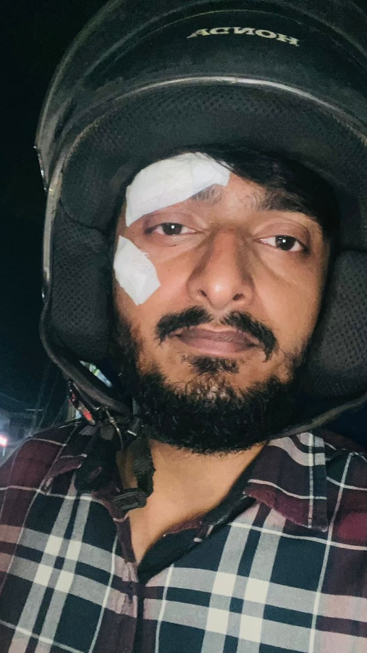 city news : हरमू में तोरणद्वार का बांस पत्रकार पर गिरा, घायल