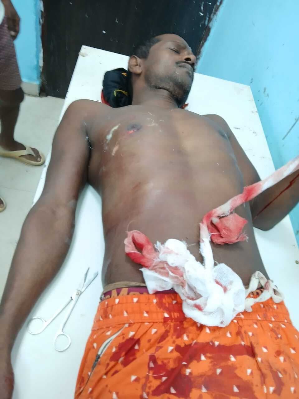 चाकूबाजी में एक घायल, आरोपी गिरफ्तार