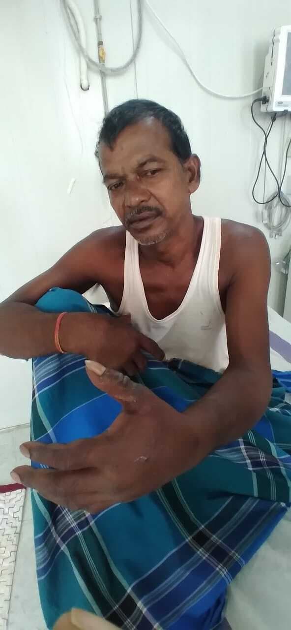 रसेल वाइपर के काटने से घायल मरीज को एंटी वेनम का 15 डोज पड़ा