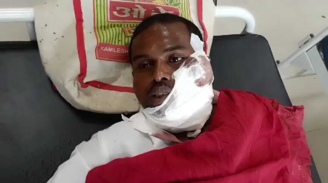 सवारी ट्रेन में छीनतई के दौरान विरोध करने पर बदमाशों ने यात्री को मारी गोली, घायल