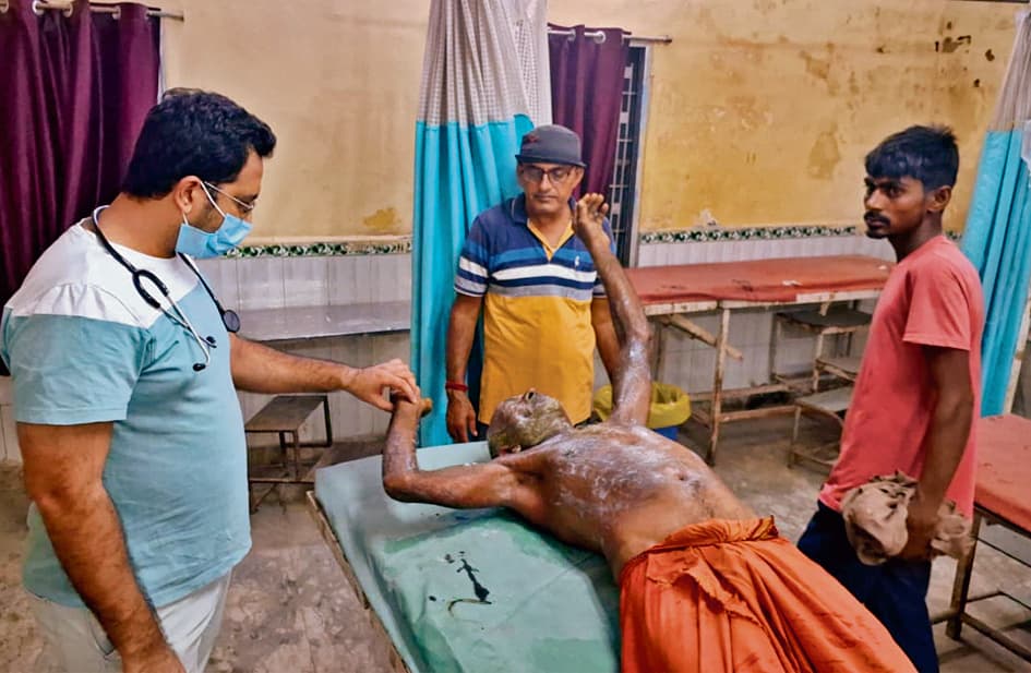 Gopalganj News : दरवाजे पर सो रहे बुजुर्ग किसान पर तेजाब से हमला, पीएमसीएच रेफर