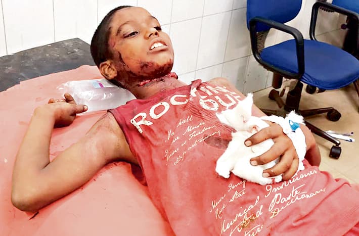 DHANBAD NEWS : आपसी विवाद में पुटकी में चाकूबाजी, दो गंभीर