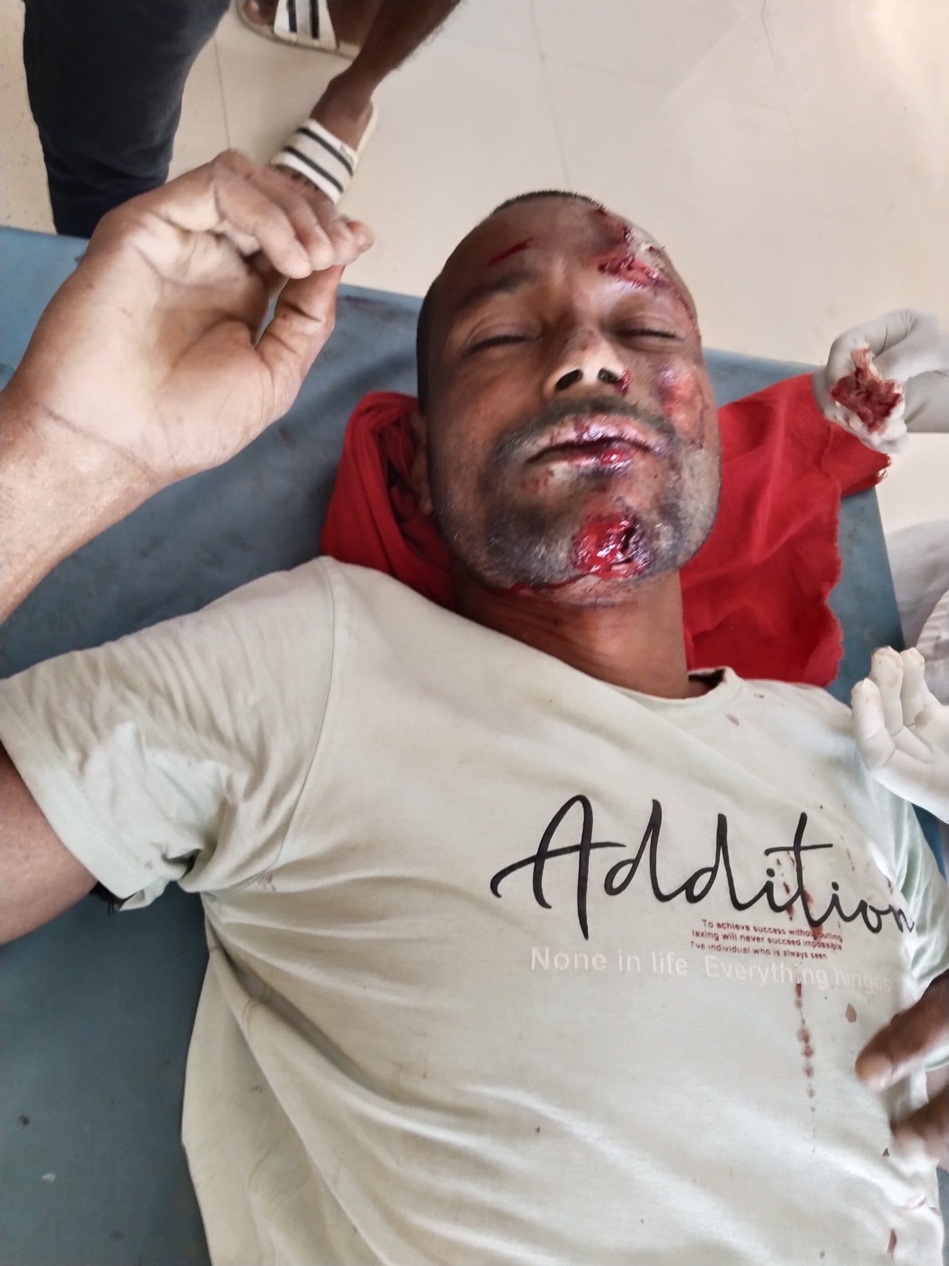 सांढ़ ने एक व्यक्ति को किया जख्मी