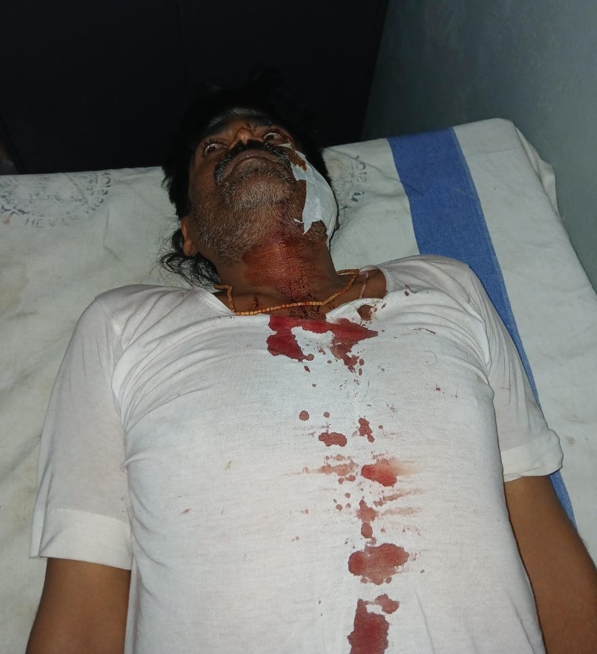 Samastipur News: बाइक सवार बदमाशों ने चाकू मारकर अधेड़ को किया जख्मी