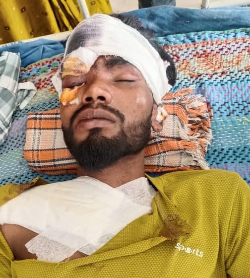 टेंपो से टक्कर में बाइक सवार दो घायल, अन्य गंभीर