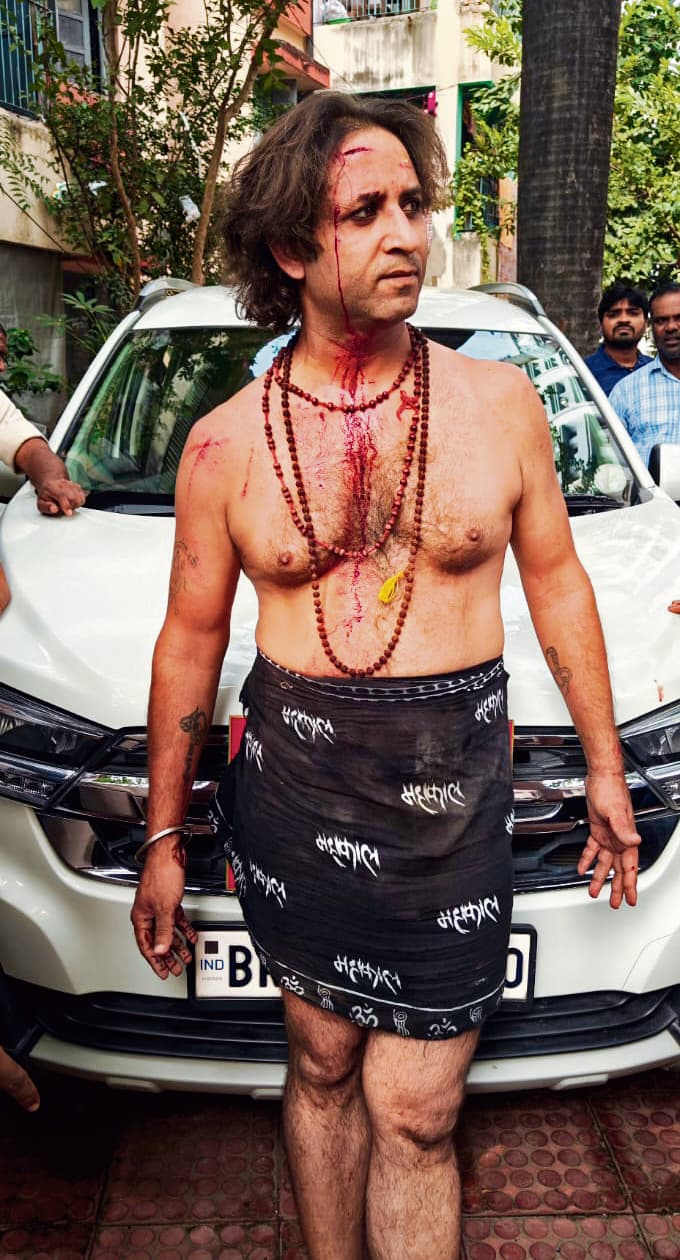 आयकर अधीक्षक के ड्राइवर ने जय महाकाल का पहले गमछा लपेटा, फिर टैक्स असिस्टेंट पर तलवार से किया हमला