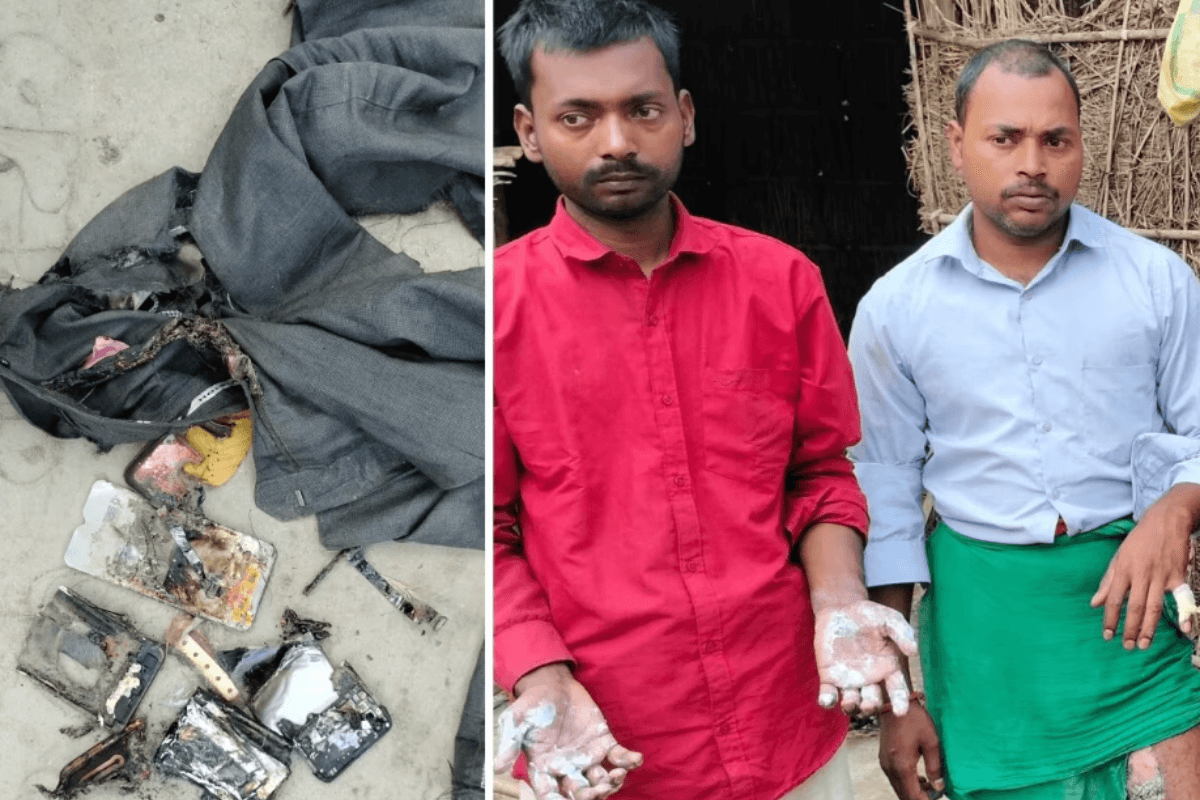 Bihar News: अचानक पैंट में फटा मोबाइल, लगी आग, बचाने में झुलसे परिजन