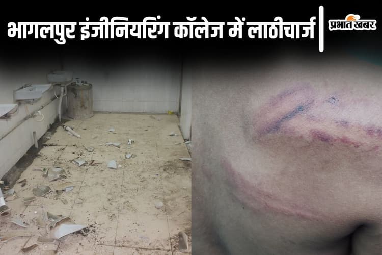 Photos: 'हमें ऐसे पीटा मानो आतंकवादी हैं', भागलपुर इंजीनियरिंग कॉलेज के हॉस्टल में पुलिस का रौद्र रूप दिखा