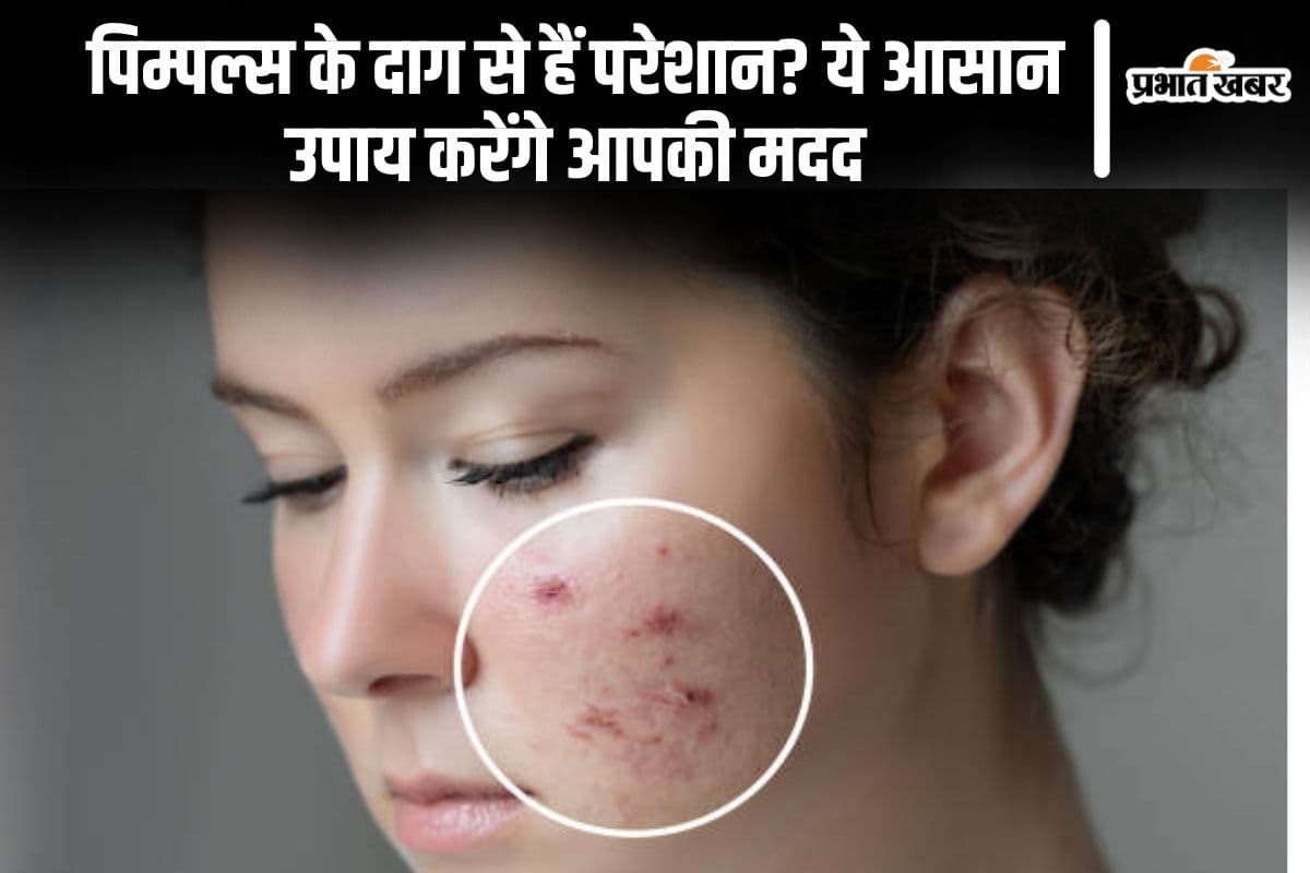 Skin Care Tips Skin Care Tips