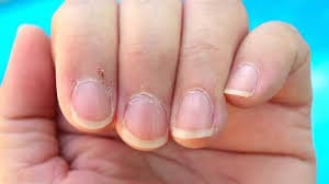 Winter Care Tips: सर्दियों में फटने लगती है नाखून के चारों तरफ की स्किन ये 5 तरह से करें केयर