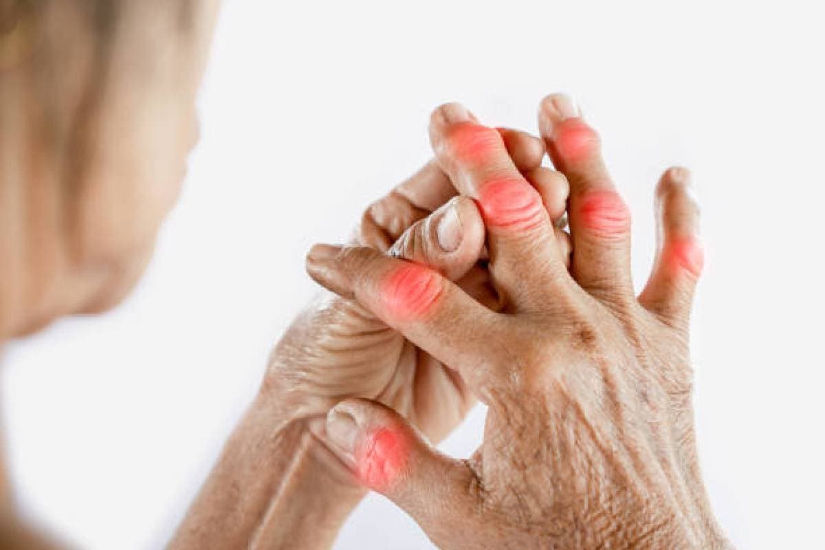 Uric Acid Problem: इस फल को खाने से कंट्रोल होगा यूरिक एसिड, बेहद सस्ता है ये फल