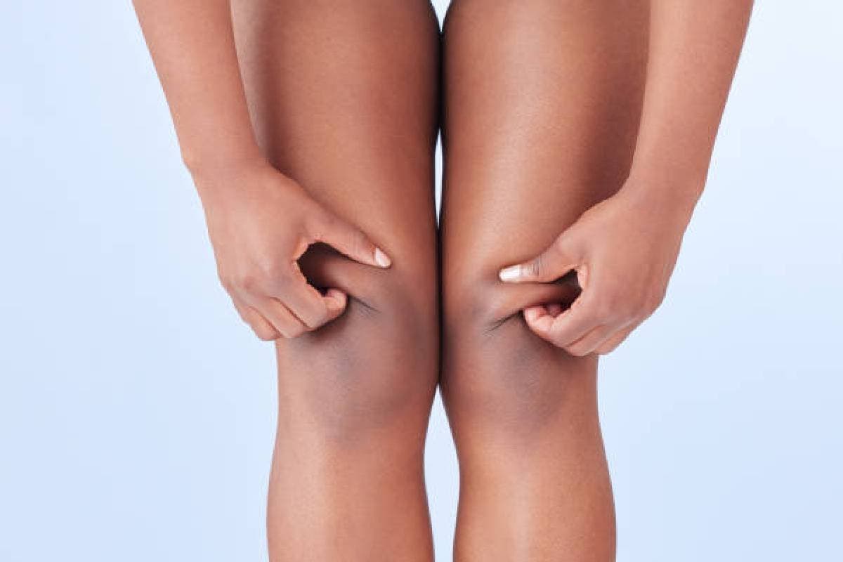 Black Knee Cleaning Tips: काले घुटने को ऐसे करें गोरा, बस लगा लें ये चीज