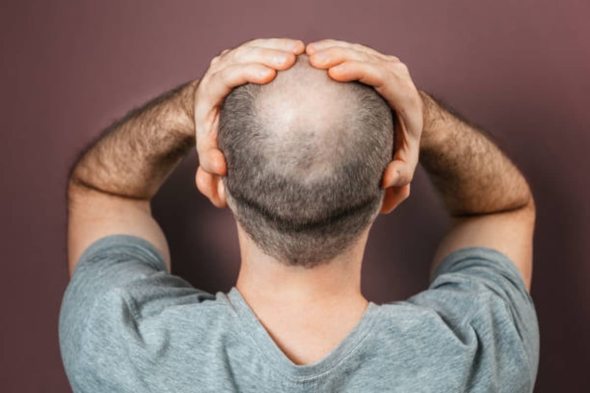 Hair Care Tips: झड़े हुए बालों को उगाने में मदद करेगा कैस्टर ऑइल, जानें इस्तेमाल करने का तरीका