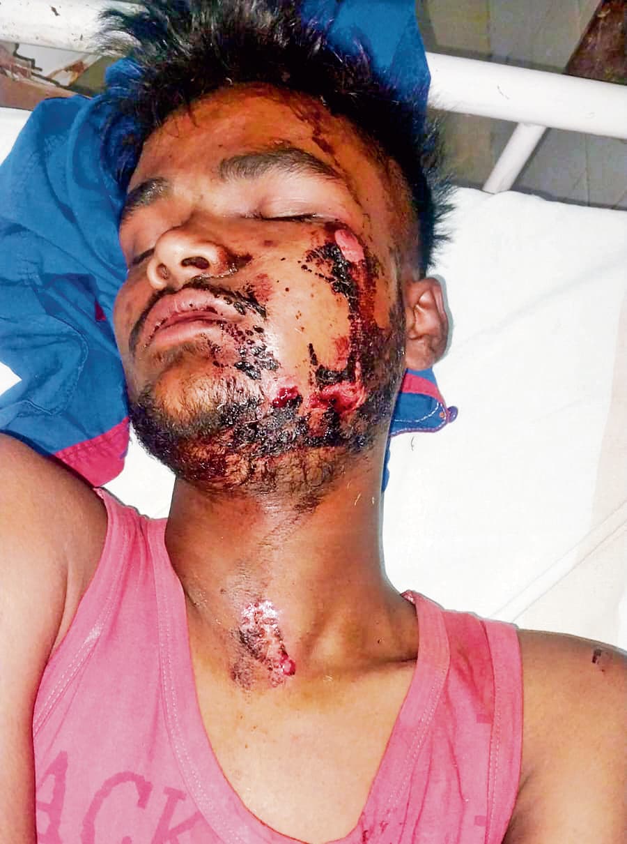 siwan news : छठ पर्व में घर आ रहे युवक को बदमाशों ने चलती ट्रेन से फेंका, हालत गंभीर