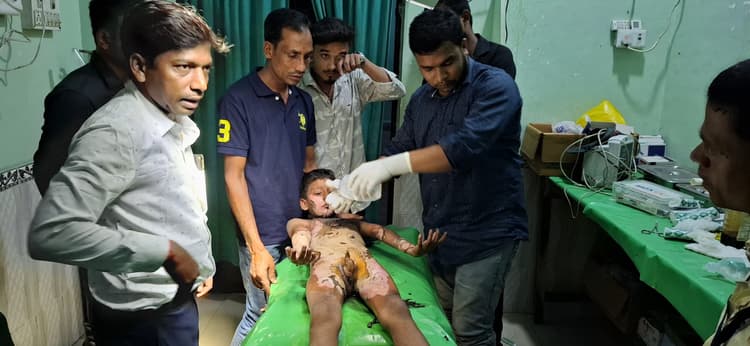 बच्चे के पॉकेट में रखा बम हुआ ब्लास्ट, दादा-पोता जख्मी