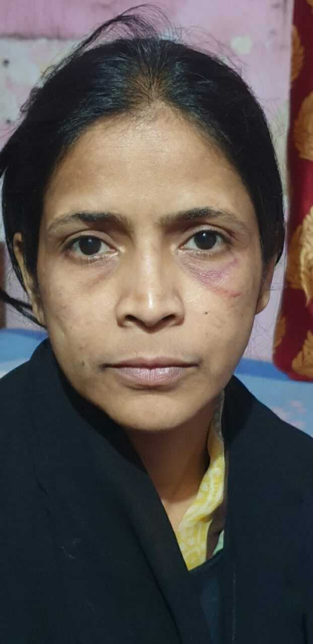 उलीडीह में महिला की मौत ,मायके पक्ष ने लगाया हत्या का आरोप, केस दर्ज