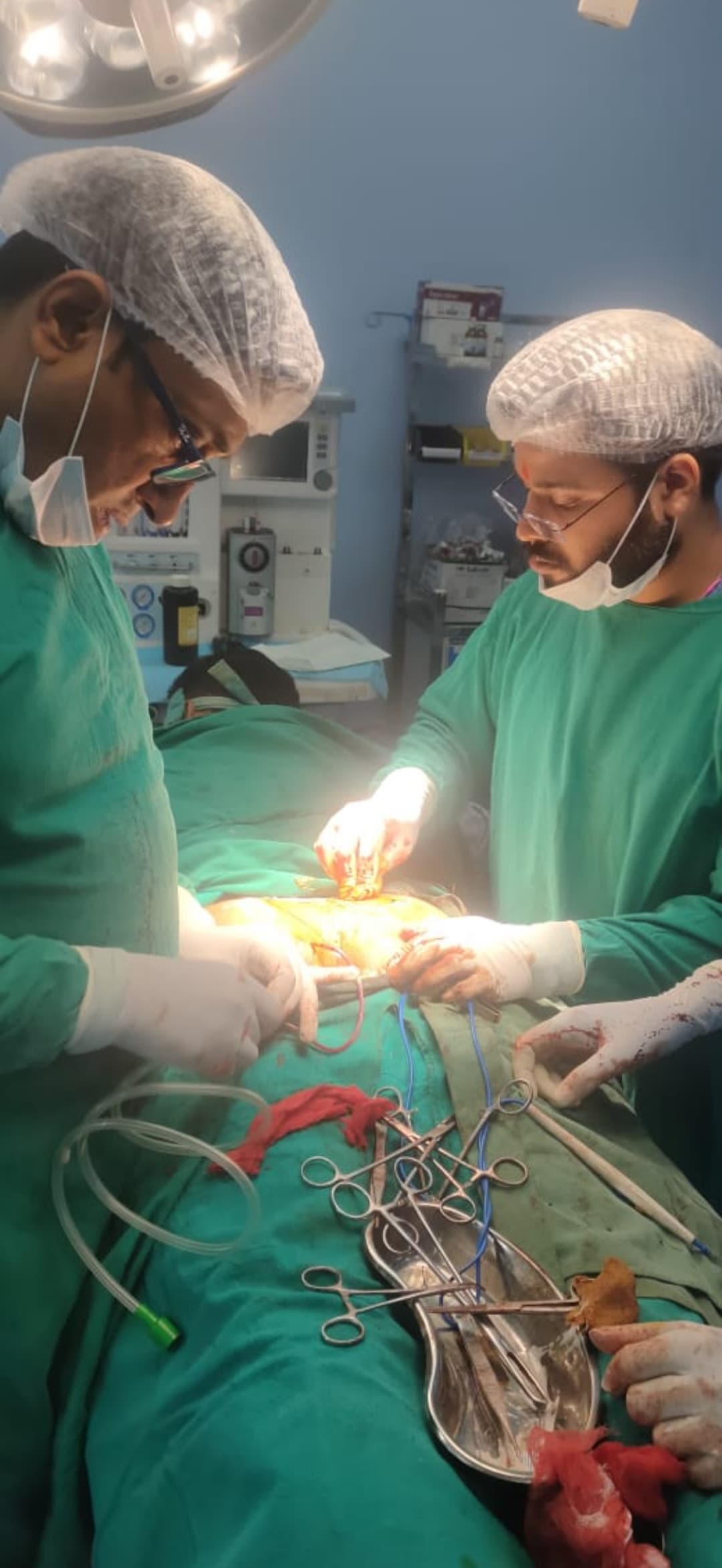 Ranchi news : सदर अस्पताल में पहली बार पाइलोनिडल साइनस की सर्जरी