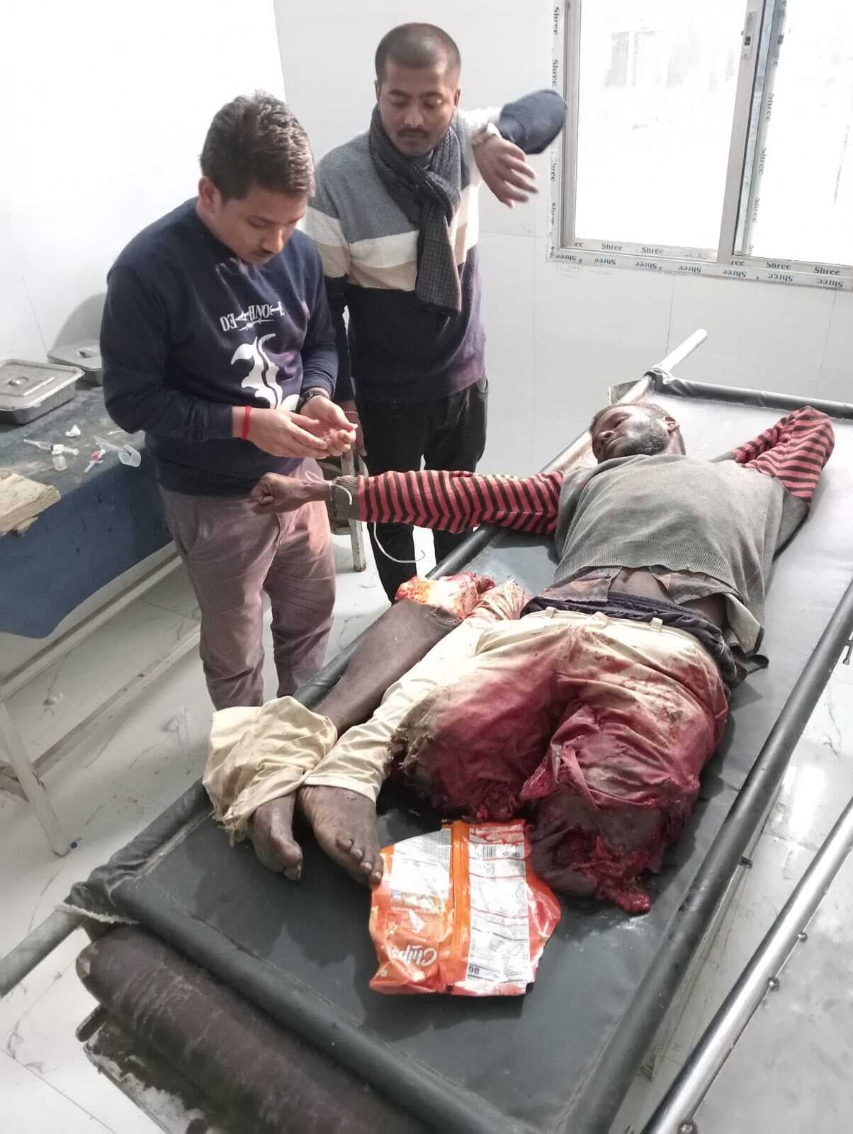 त्रिपुरा से मजदूरी कर नालंदा घर लौट रहे मजदूर का ट्रेन से कटा दोनों पैर