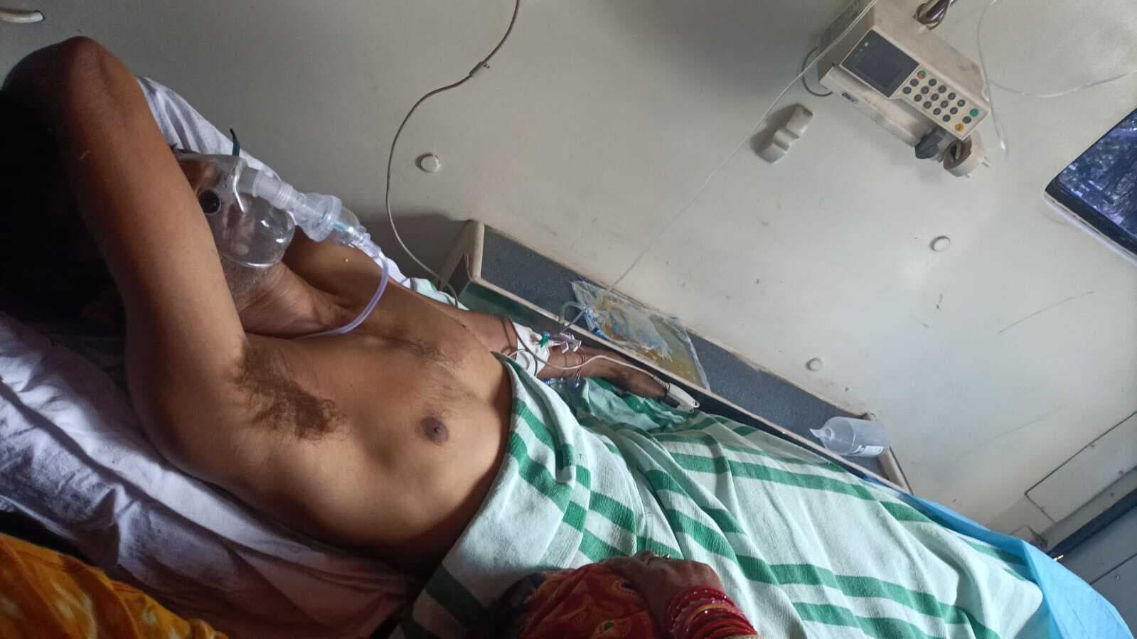 Rourkela News: आरएसपी के कोक-ओवन में दुर्घटना, ठेका श्रमिक के दोनों पैर कटे, भुवनेश्वर रेफर